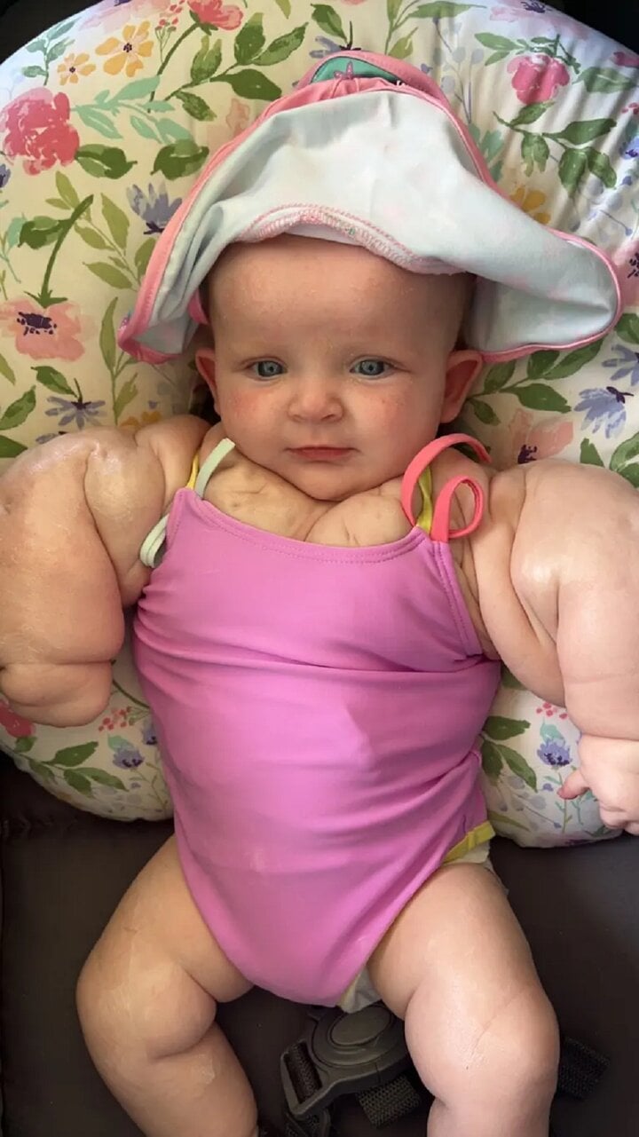 Bé gái 9 tháng tuổi có thân thể như vận động viên thể hình - Ảnh 1.