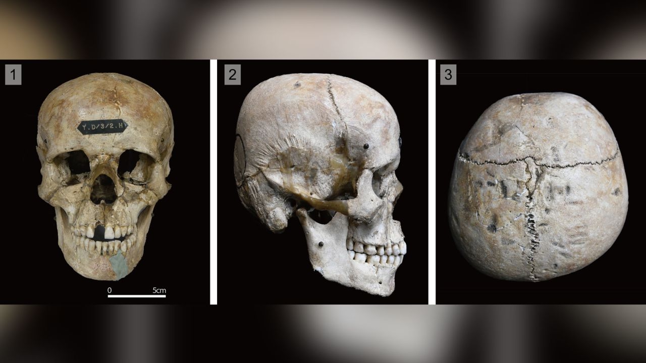 Bí ẩn về những hộp sọ Nhật Bản cổ đại bị “biến dạng” - Ảnh 1.