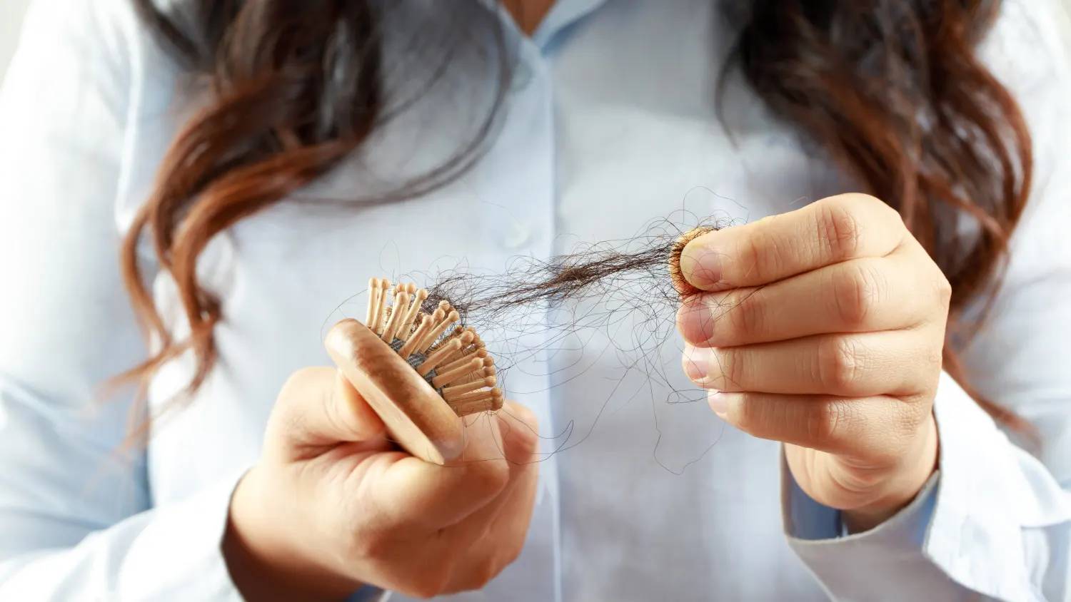Rụng lông, tóc ở 3 vùng trên cơ thể có thể là dấu hiệu cảnh báo bạn đang mắc bệnh này- Ảnh 3.