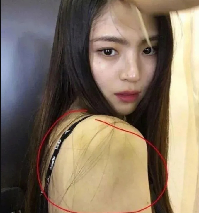 Truyền thông Hoa ngữ đặt nghi vấn Han So Hee bị bạo hành do xuất hiện nhiều vết bầm tím trên cơ thể - Ảnh 6.