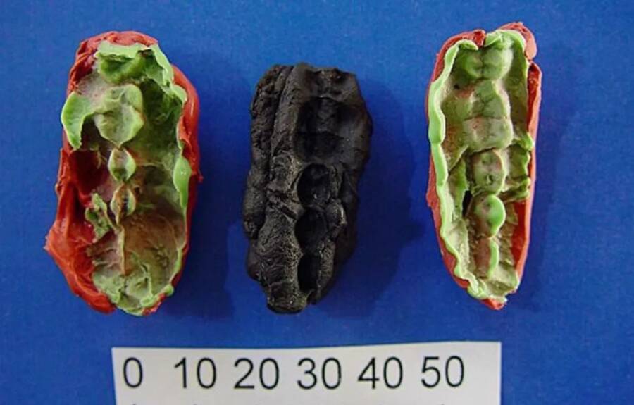 'Kẹo cao su' 10.000 năm tuổi tiết lộ sức khoẻ răng miệng của cư dân thời đồ đá - Ảnh 1.
