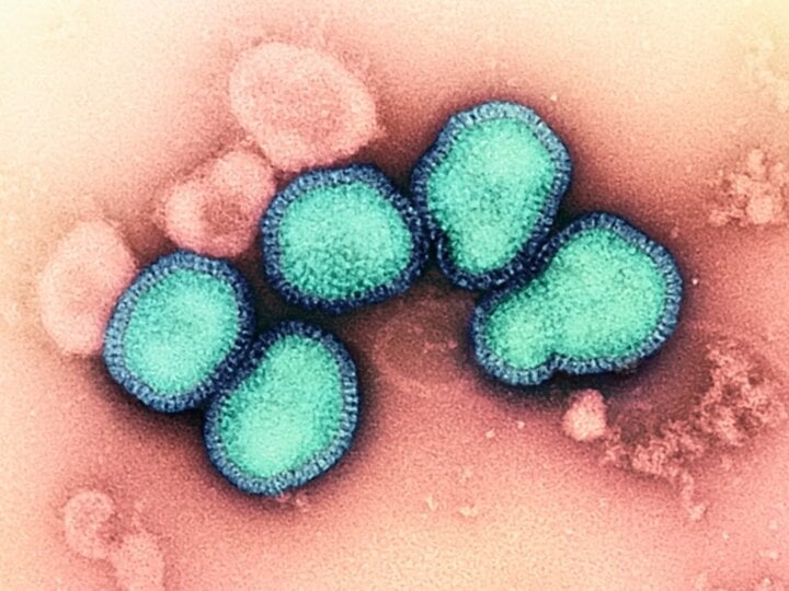 Trung Quốc xuất hiện ca tử vong do nhiễm hỗn hợp virus cúm A/H3N2 và H10N5 - Ảnh 1.