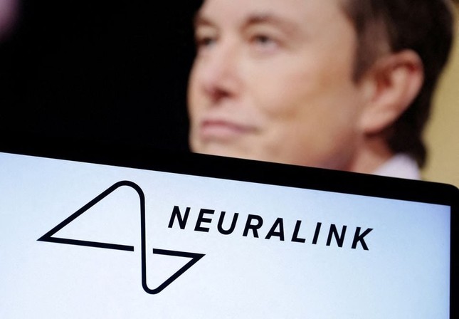 Công ty của tỷ phú Elon Musk lần đầu tiên cấy chip vào não người - Ảnh 1.