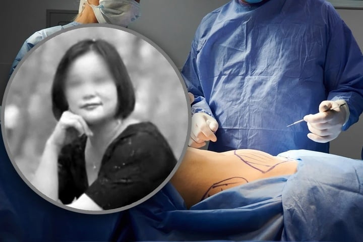 Người phụ nữ tử vong do phẫu thuật thẩm mỹ 6 lần trong một ng&agrave;y - Ảnh 1.