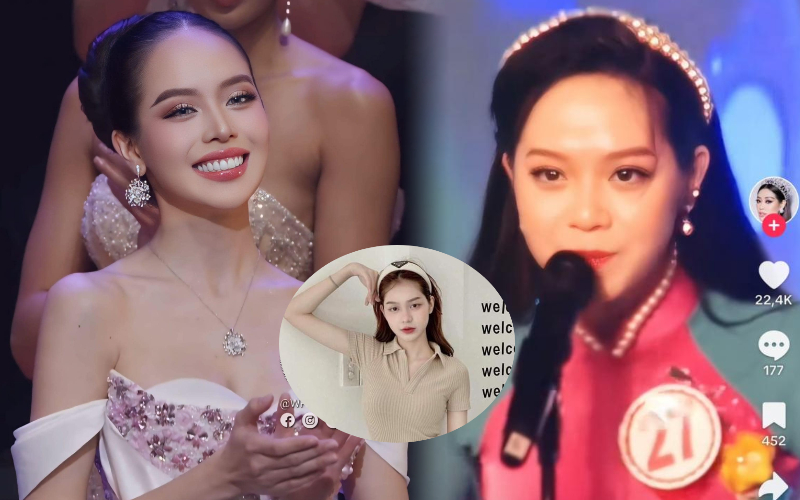 Hoa hậu Thanh Thủy đăng quang Miss International 2024: Loạt ảnh trước khi phẫu thuật thẩm mỹ gây sốt trở lại, có gì khác biệt?