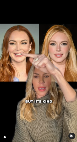 lindsay-lohan-su-dung-sculptra-de-cai-lao-hoan-dong3jpg-1732694070746939598144.png