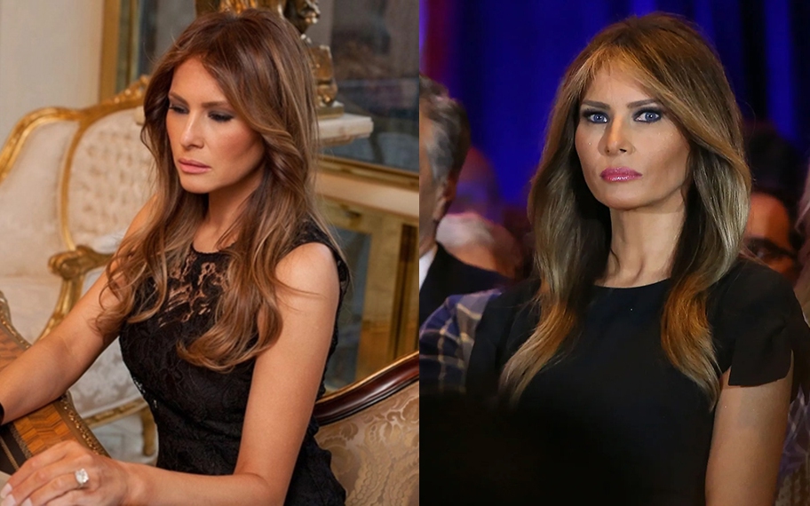 Bà Melania Trump không tiêm botox để xóa nhăn vì sợ hỏng cơ mặt, liệt dây thần kinh: Sự thật là gì?