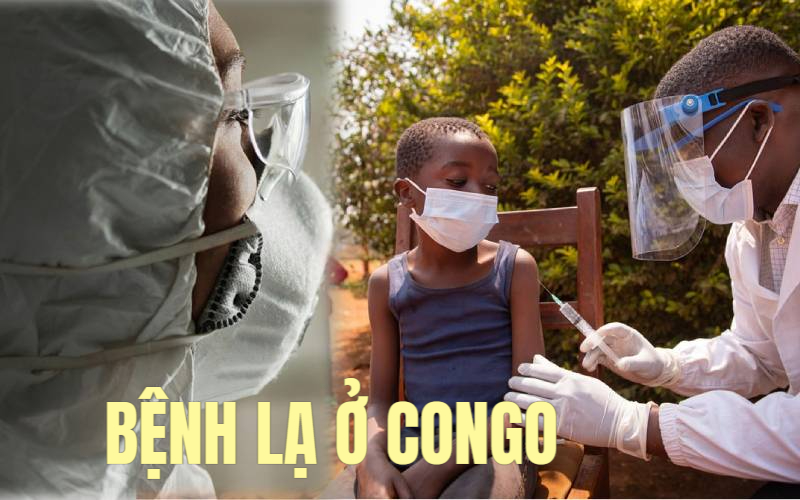 Bệnh bí ẩn khiến hàng trăm người mắc và tử vong ở Congo có triệu chứng giống bệnh cúm, WHO nghi ngờ là sốt rét