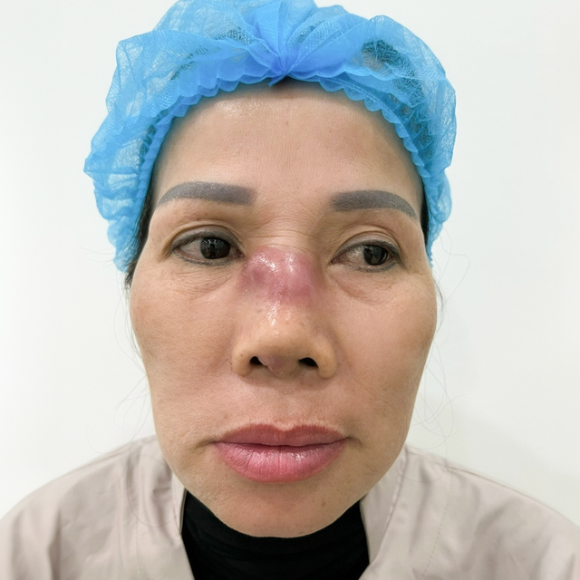 Ph&ograve;ng kh&aacute;m chuy&ecirc;n khoa thẩm mỹ Dr Định - địa điểm tin cậy gửi gắm niềm tin của kh&aacute;ch h&agrave;ng - Ảnh 2.