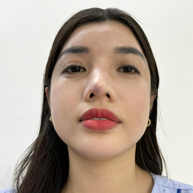 Ph&ograve;ng kh&aacute;m chuy&ecirc;n khoa thẩm mỹ Dr Định - địa điểm tin cậy gửi gắm niềm tin của kh&aacute;ch h&agrave;ng - Ảnh 3.