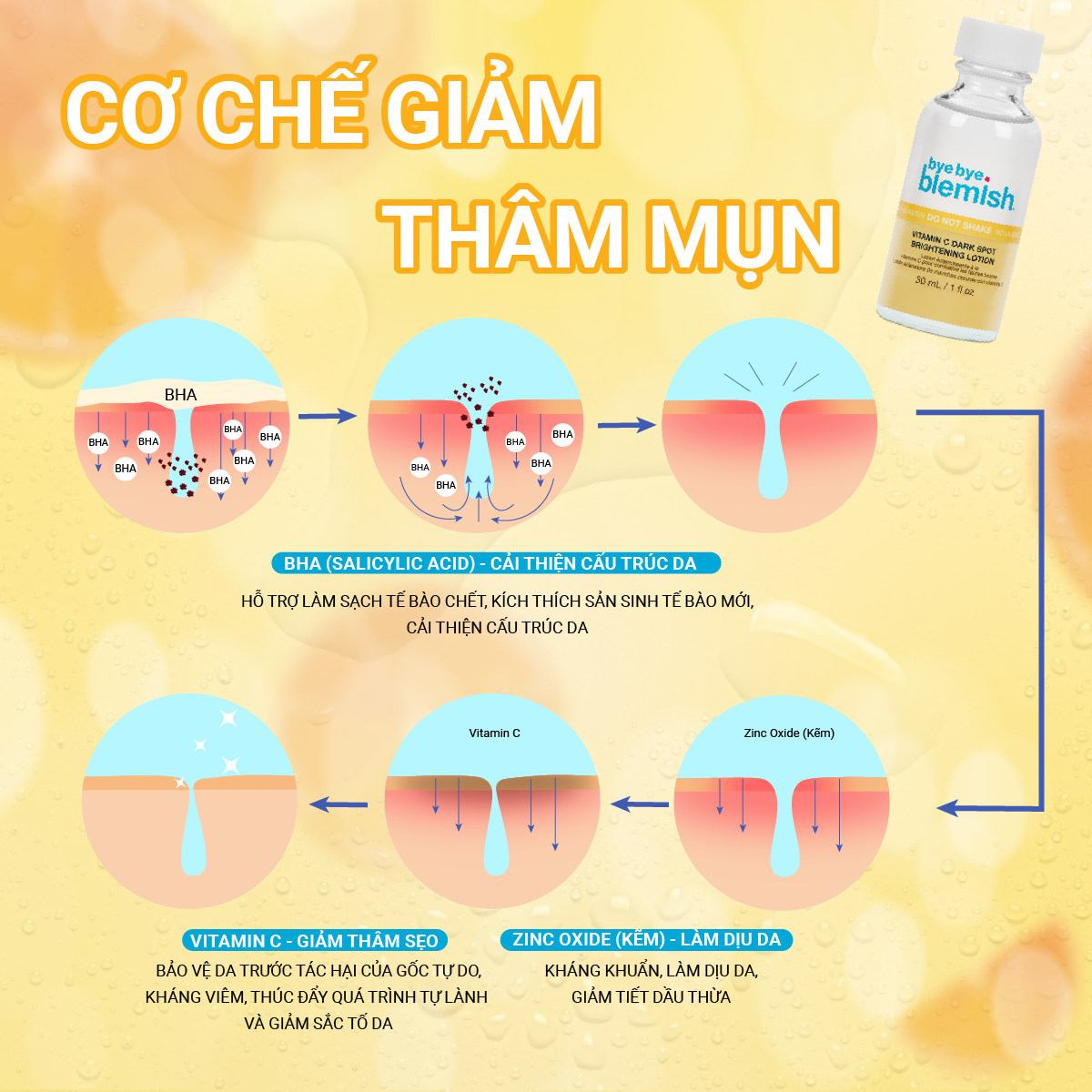 5 sản phẩm giảm mụn, mờ thâm cực đỉnh ai dùng cũng mê - Ảnh 2.