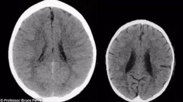 Những thay đổi đáng kinh ngạc về IQ của trẻ sau khi bị cha mẹ đánh mắng - Ảnh 2.