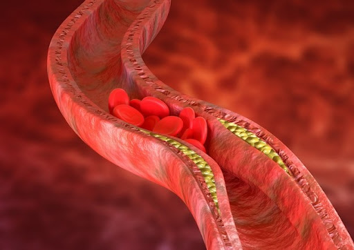 Sau Tết, đây là 9 cách giúp làm sạch mạch máu, giảm cholesterol rất nhanh - Ảnh 1.