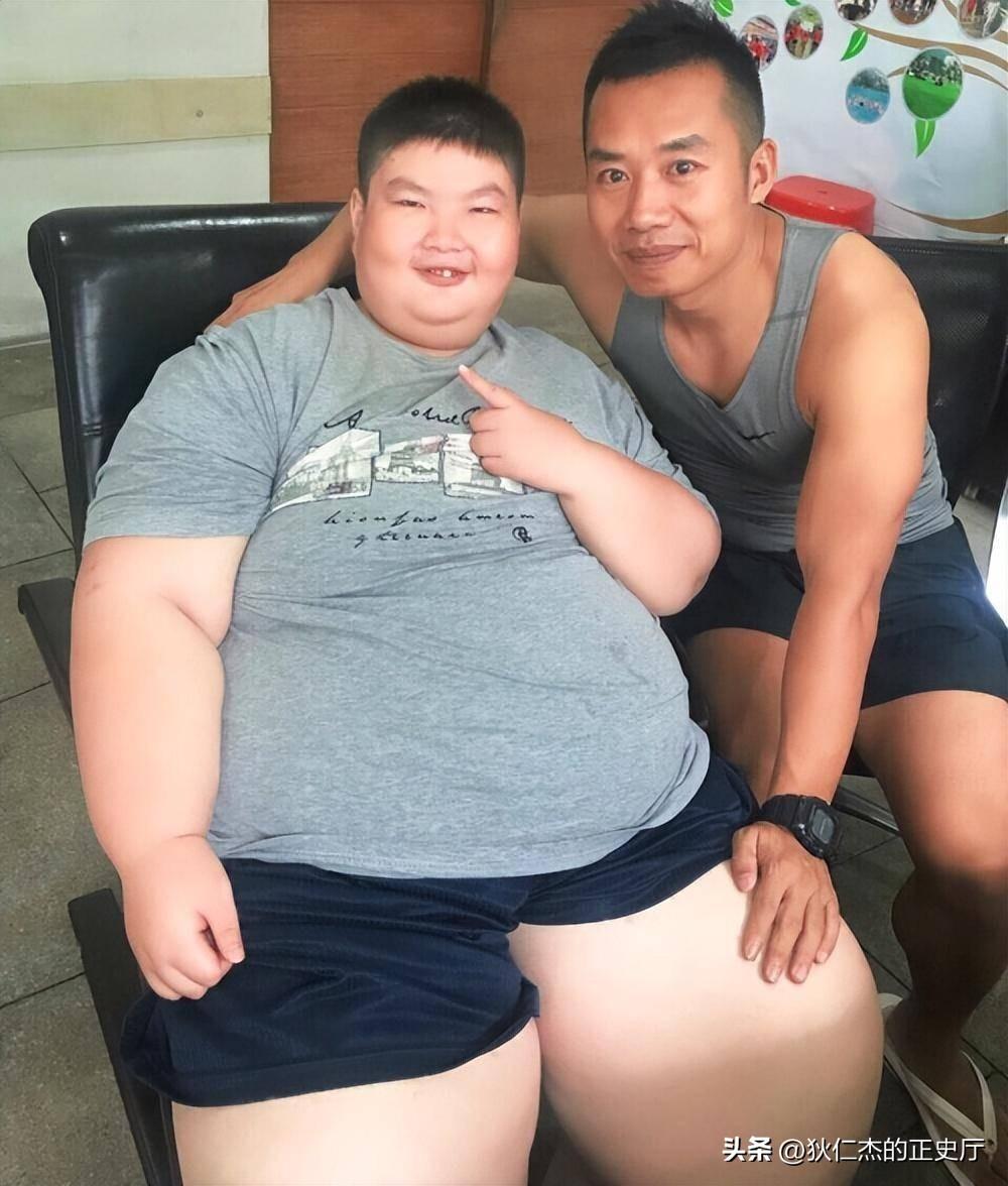&quot;Cậu bé nặng nhất Trung Quốc&quot; 14 tuổi đã 150kg, có thể ăn 1 thùng mì gói 1 ngày có kết cục ra sao?- Ảnh 4.