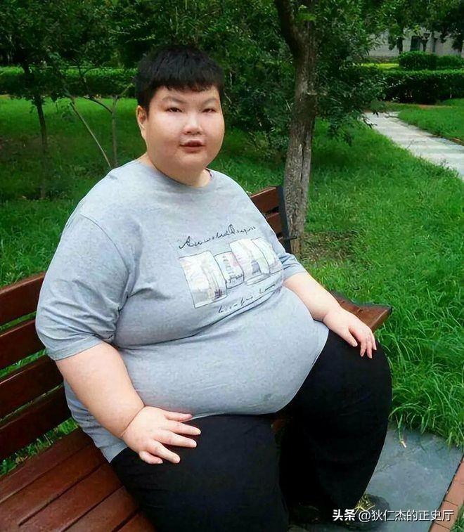 &quot;Cậu bé nặng nhất Trung Quốc&quot; 14 tuổi đã 150kg, có thể ăn 1 thùng mì gói 1 ngày có kết cục ra sao?- Ảnh 3.