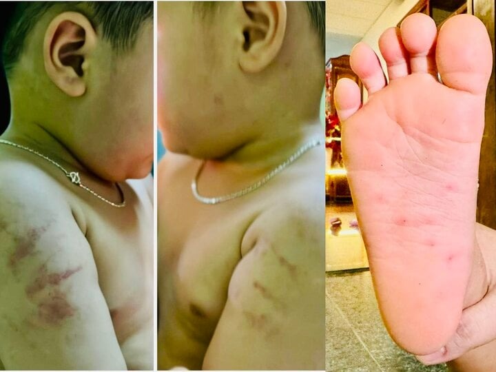 Vụ bé gái 4 tuổi nghi bị bạo hành ở Bình Định: Người thân hé lộ tình trạng sức khỏe - Ảnh 1.