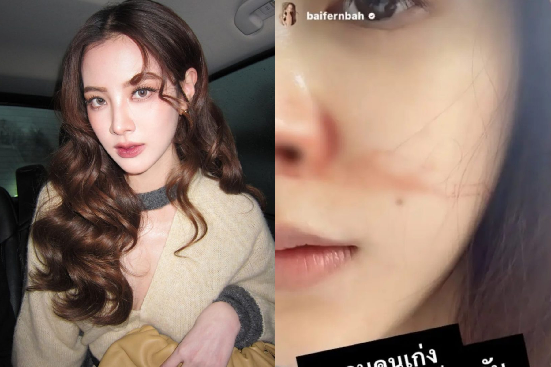 Baifern bất ngờ nhập viện truyền nước biển, bạn trai Nine Naphat lập tức có động thái đáng chú ý- Ảnh 3. Baifern bất ngờ nhập viện truyền nước biển, bạn trai Nine Naphat lập tức có động thái đáng chú ý- Ảnh 3.