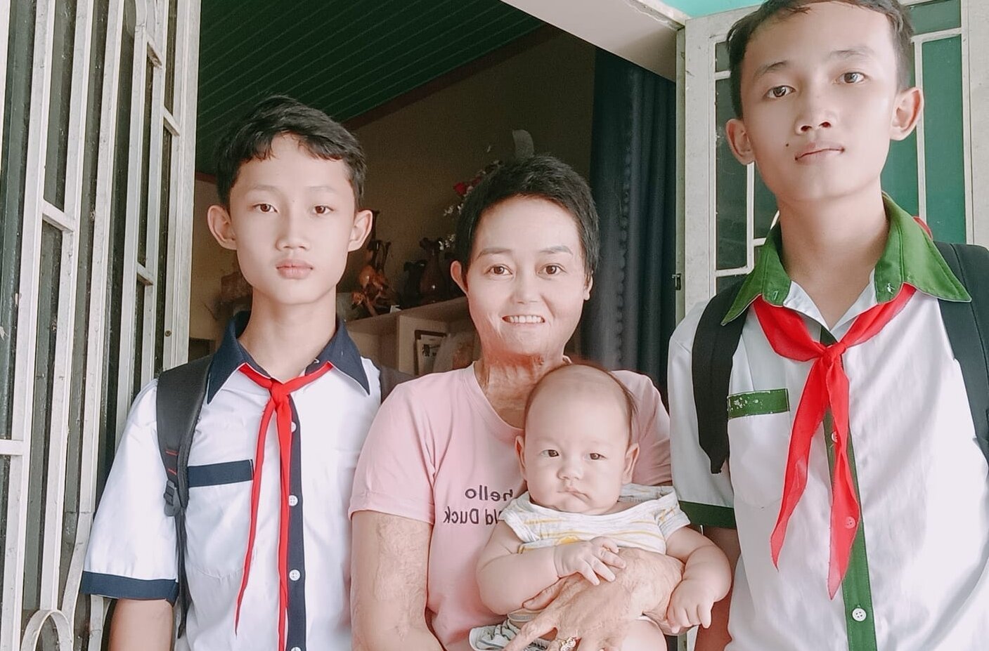Sau hàng chục ca mổ, người phụ nữ bị chồng đổ xăng đốt bỏng 92% hiện ra sao? - Ảnh 2. Sau hàng chục ca mổ, người phụ nữ bị chồng đổ xăng đốt bỏng 92% hiện ra sao? - Ảnh 2.
