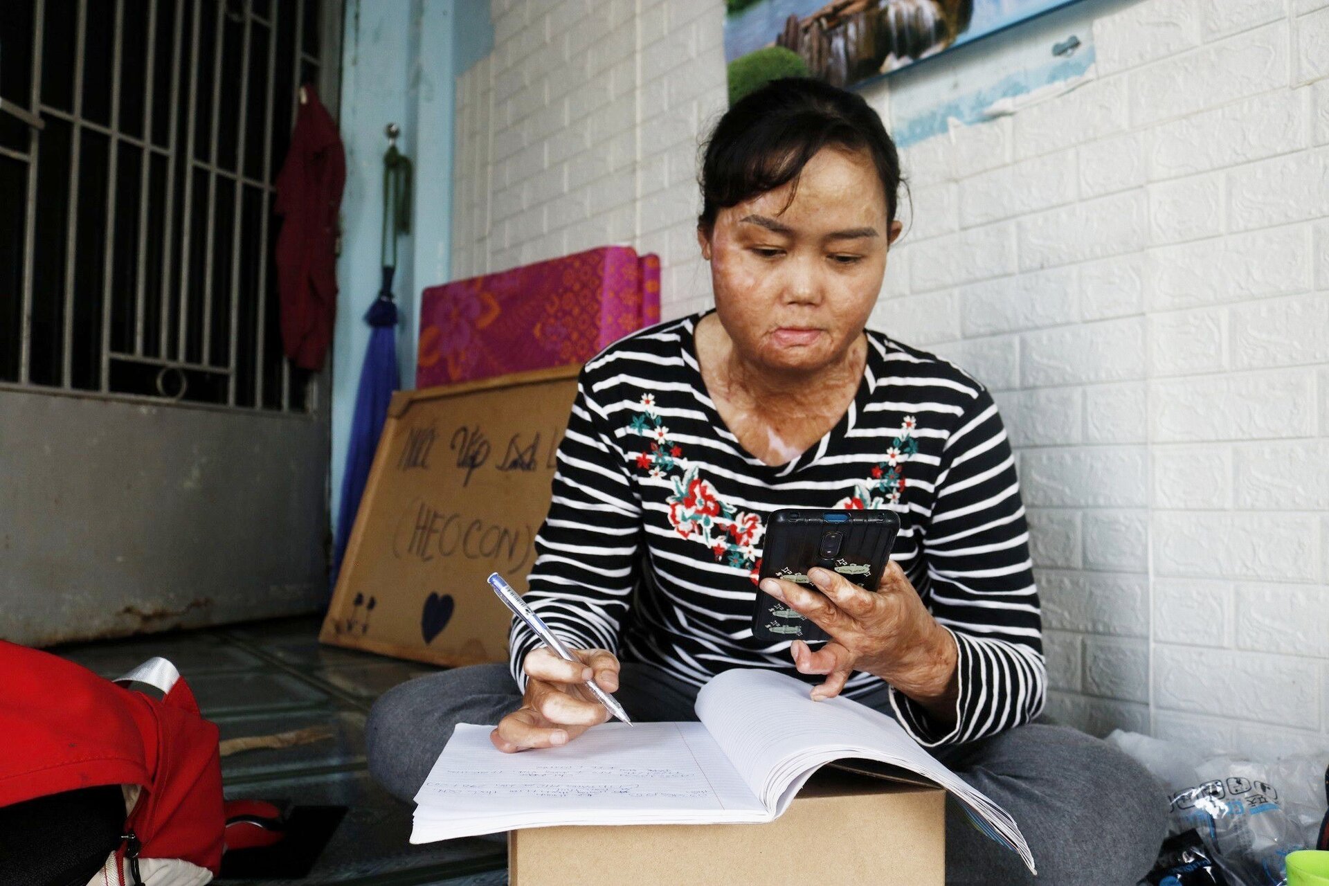 Sau hàng chục ca mổ, người phụ nữ bị chồng đổ xăng đốt bỏng 92% hiện ra sao? - Ảnh 1. Sau hàng chục ca mổ, người phụ nữ bị chồng đổ xăng đốt bỏng 92% hiện ra sao? - Ảnh 1.