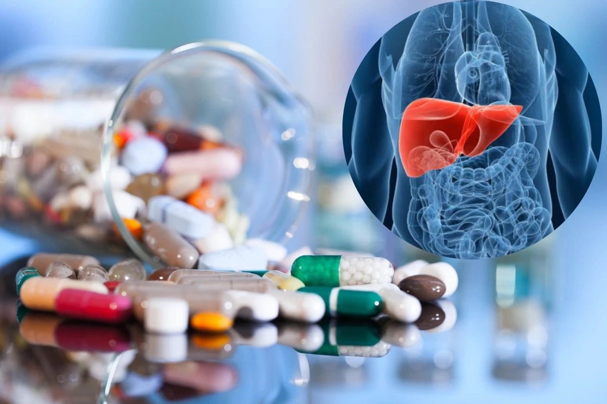 Người bệnh có nên tự mua và sử dụng thuốc và thực phẩm bổ gan? - Ảnh 1. Người bệnh có nên tự mua và sử dụng thuốc và thực phẩm bổ gan? - Ảnh 1.