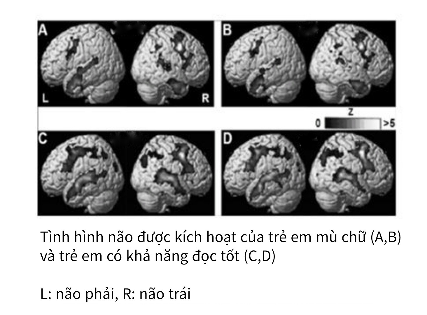 Bộ não của trẻ chăm chỉ đọc với không đọc có sự khác biệt cực lớn: Không lưu ý, 10 năm sau cha mẹ mới ngỡ ngàng- Ảnh 2.