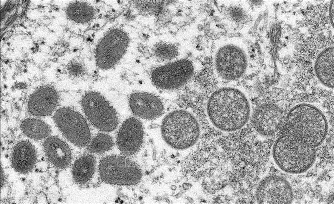 Kiên Giang ghi nhận 3 trường hợp mắc bệnh đậu mùa khỉ - Ảnh 1.
