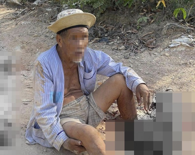 Truy tìm chiếc xe tông dập nát hai bàn chân cụ ông 85 tuổi rồi bỏ trốn - Ảnh 1.