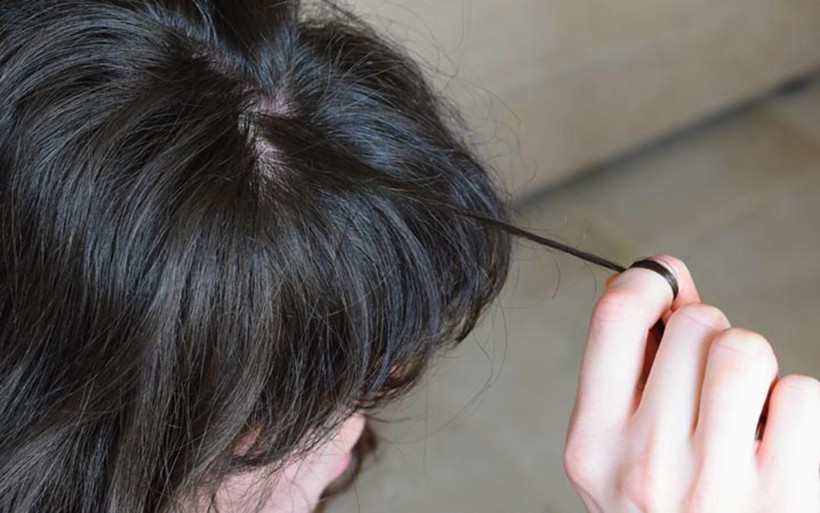 Trẻ nghiện nhổ t&oacute;c, cha mẹ n&ecirc;n l&agrave;m g&igrave;? - Ảnh 3.