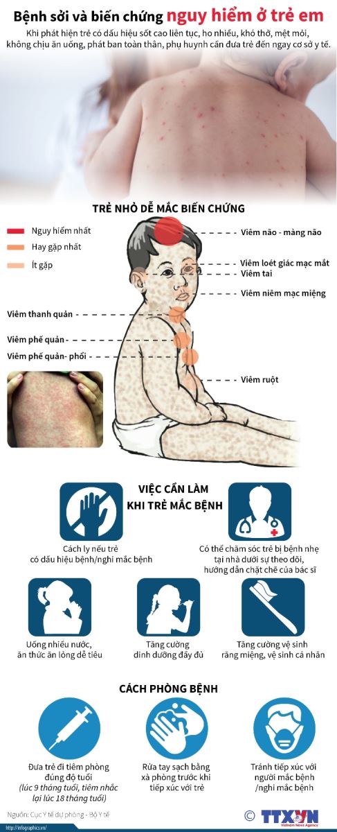 Số ca sốt phát ban nghi sởi tăng 2,7 lần so với cùng kỳ năm 2023 - Ảnh 1.