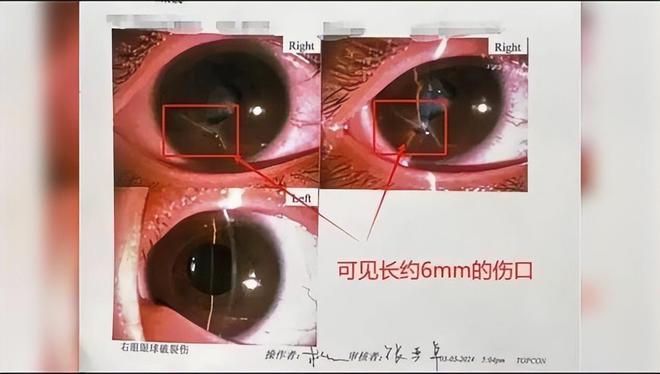 Cậu bé 10 tuổi bị kéo cứa vào mắt mà không dám nói: Thế gian này có một kiểu gia đình đáng sợ hơn cả bạo lực học đường - Ảnh 1.