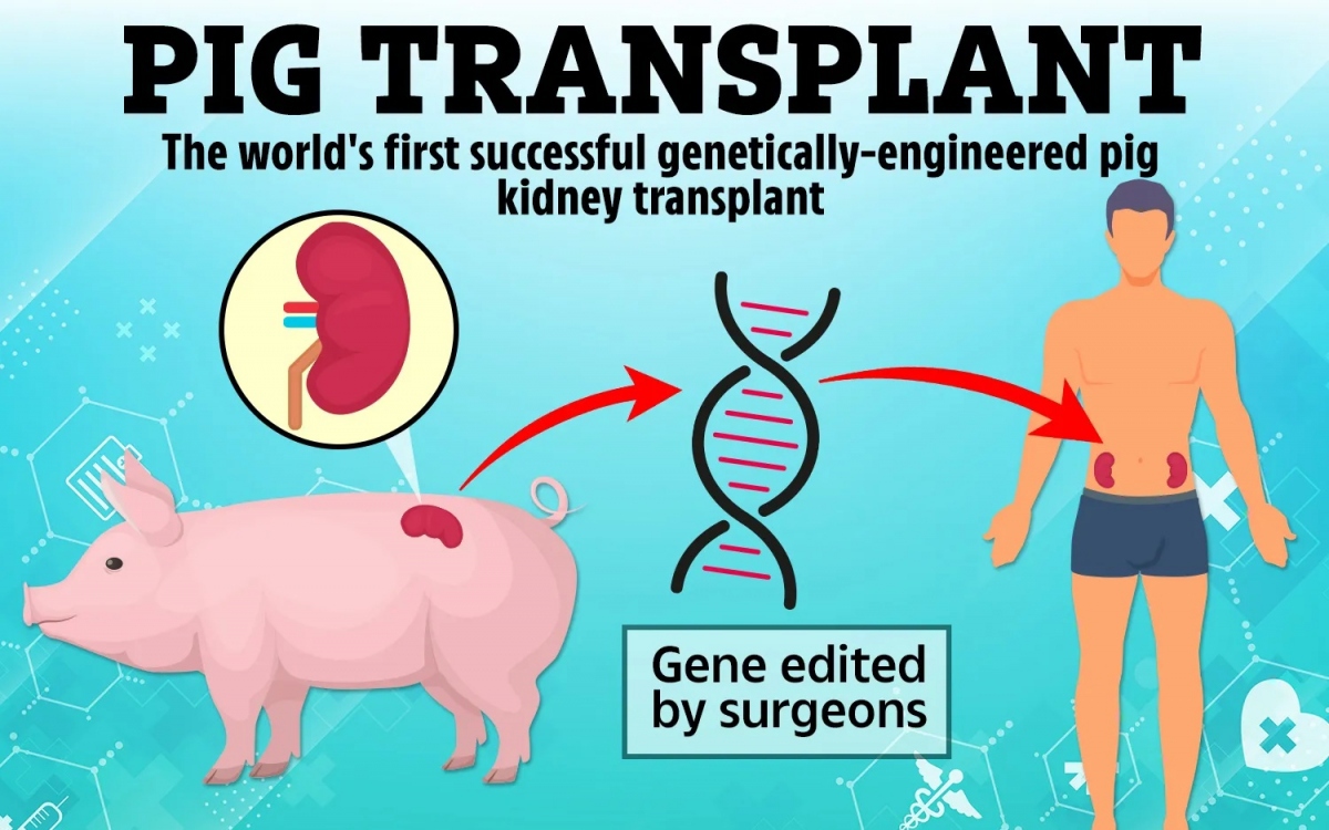 Bệnh viện lên tiếng về trường hợp bệnh nhân đầu tiên được ghép thận lợn qua đời