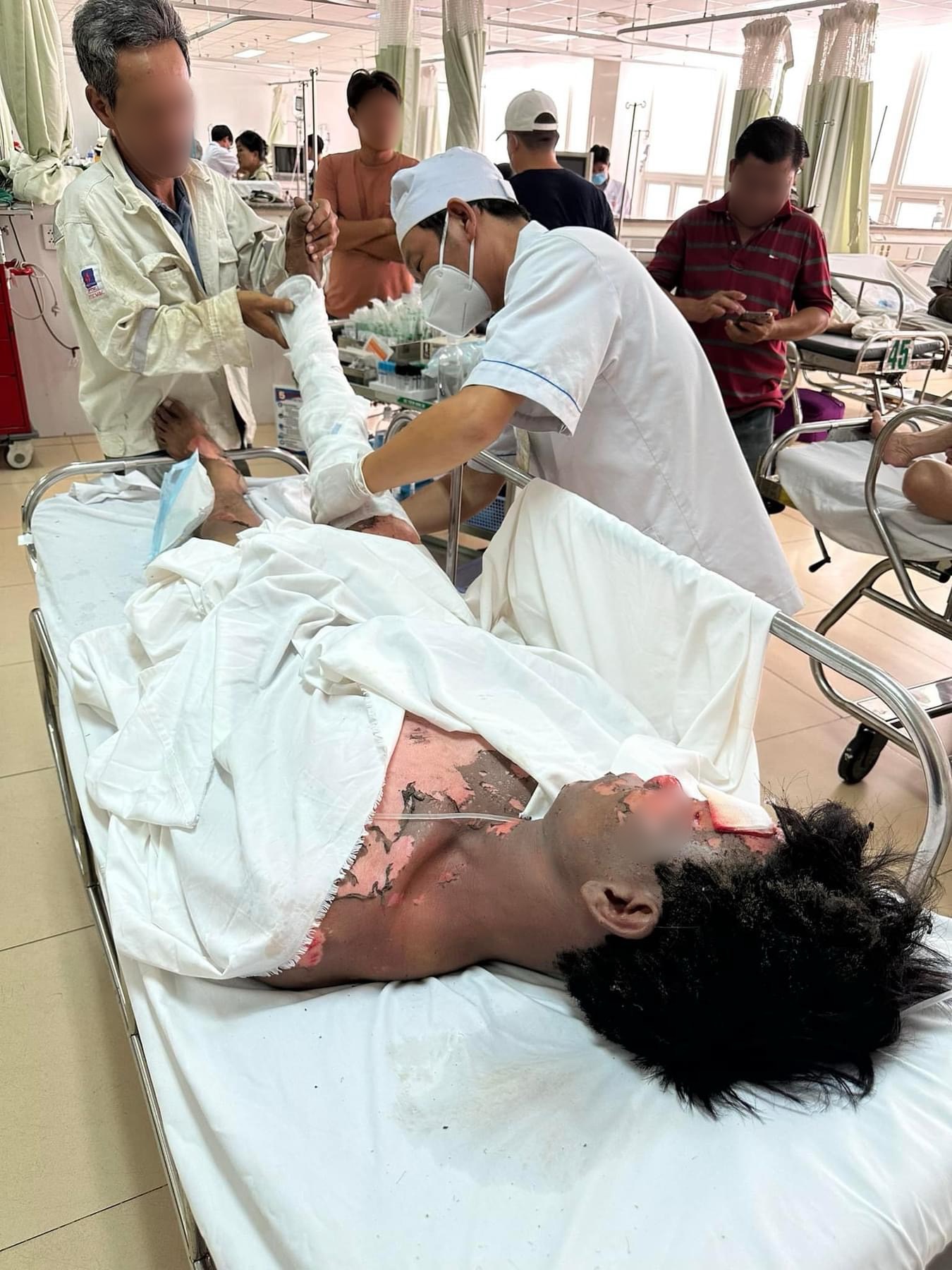 Một công nhân bị điện giật gây bỏng nặng phải nhập viện cấp cứu - Ảnh 1.