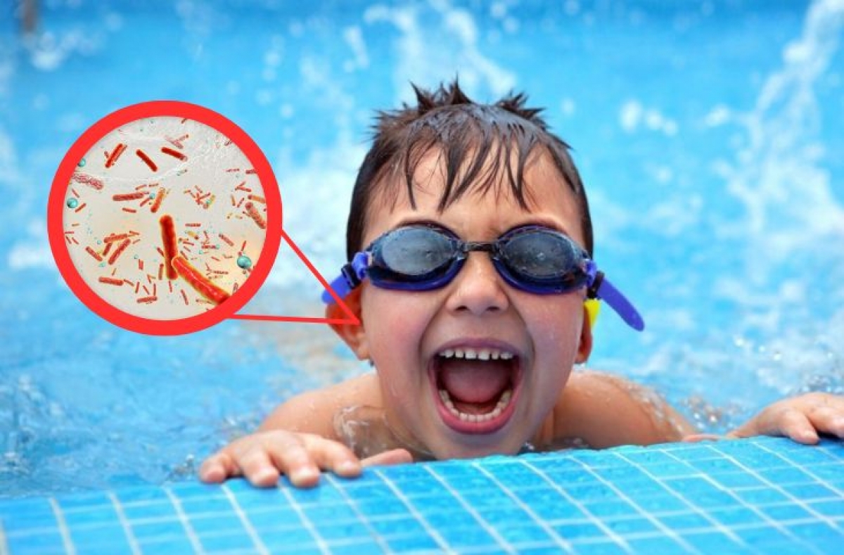 Bác sĩ hướng dẫn cách phòng tránh viêm tai khi bơi lội trong ngày hè - Ảnh 1.
