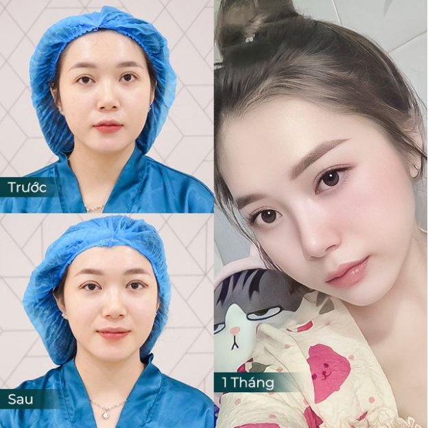 Thẩm mỹ viện Davinci - Địa chỉ làm đẹp đáng lưu tâm cho khách hàng - Ảnh 4. Thẩm mỹ viện Davinci - Địa chỉ làm đẹp đáng lưu tâm cho khách hàng - Ảnh 4.