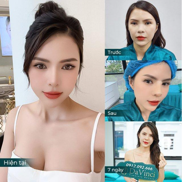 Thẩm mỹ viện Davinci - Địa chỉ làm đẹp đáng lưu tâm cho khách hàng - Ảnh 5. Thẩm mỹ viện Davinci - Địa chỉ làm đẹp đáng lưu tâm cho khách hàng - Ảnh 5.