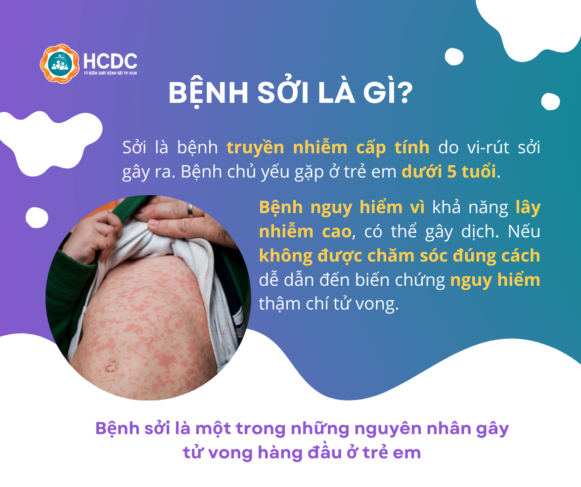 Infographic: Tiêm vaccine sởi ngay khi trẻ đủ 9 tháng tuổi  - Ảnh 2.