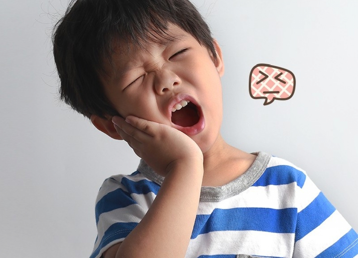 Ph&ograve;ng ngừa s&acirc;u răng ở trẻ - Ảnh 1.