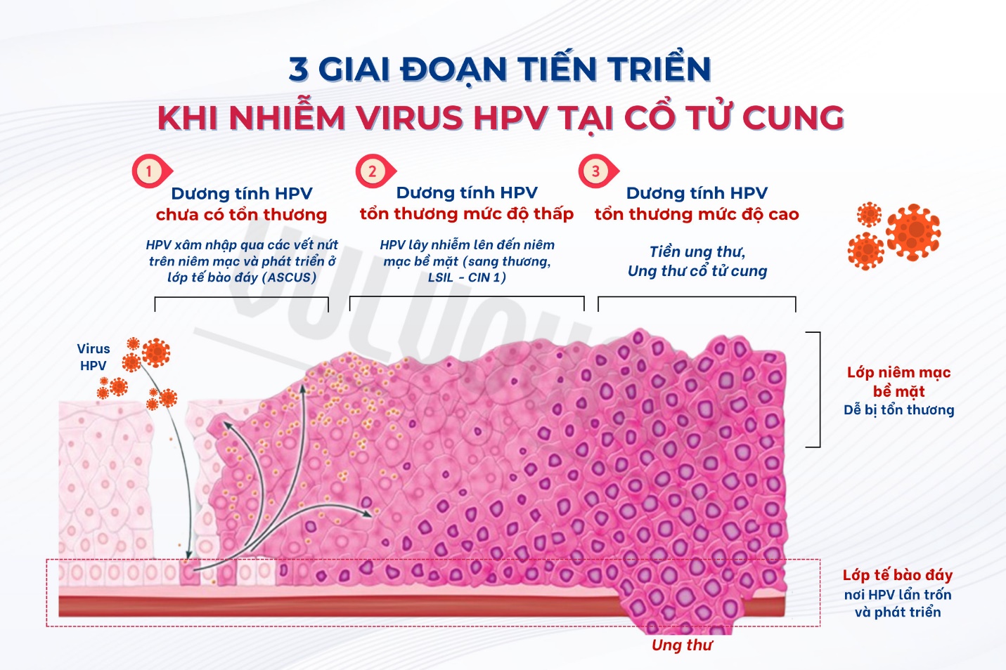 Nhiễm HPV cổ tử cung: Chớ vội hoang mang - Ảnh 1.