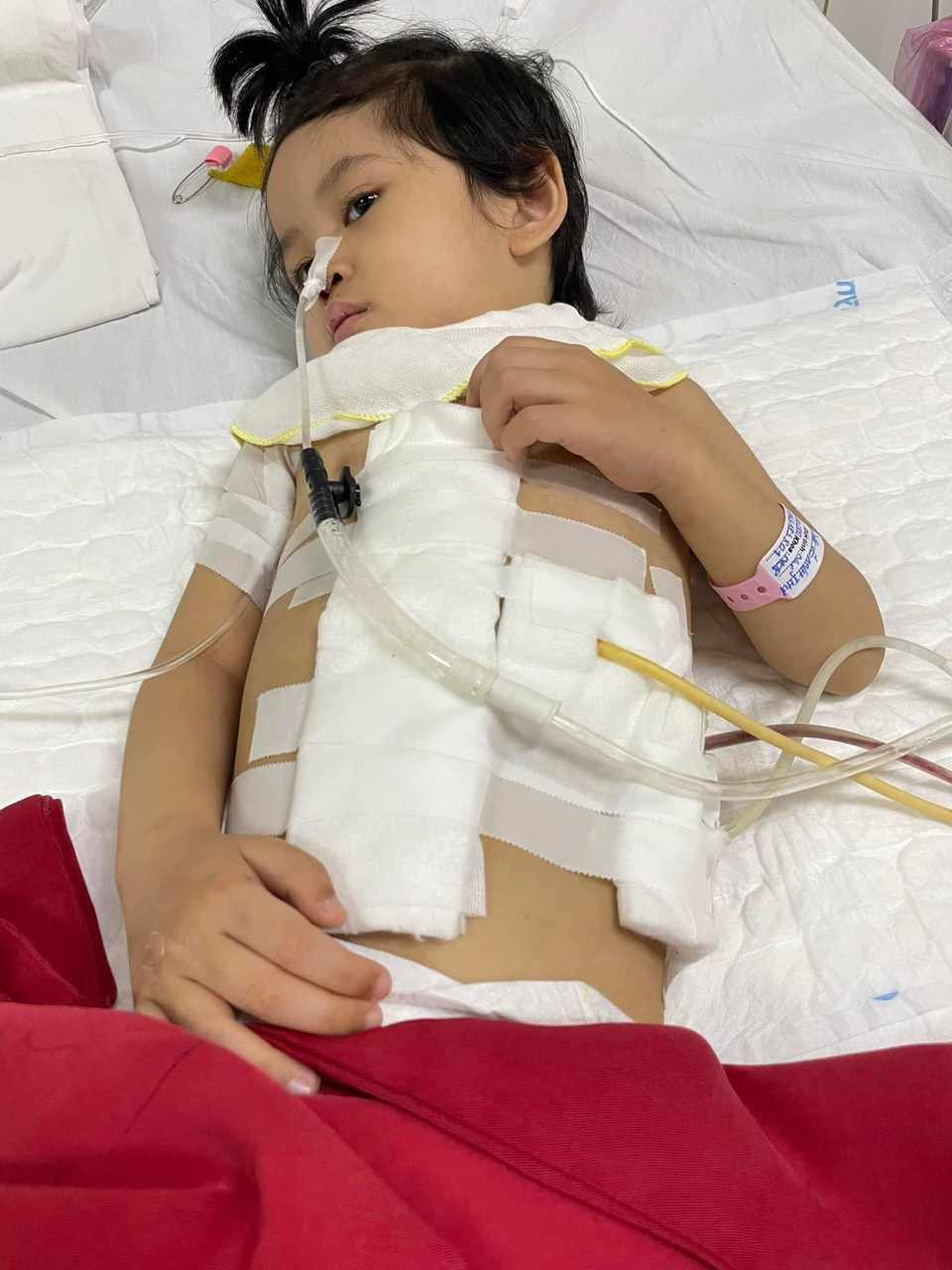 &Aacute;nh mắt cầu cứu của b&eacute; g&aacute;i 5 tuổi dị tật bẩm sinh, bị cha chối bỏ từ khi c&ograve;n trong bụng mẹ- Ảnh 1.