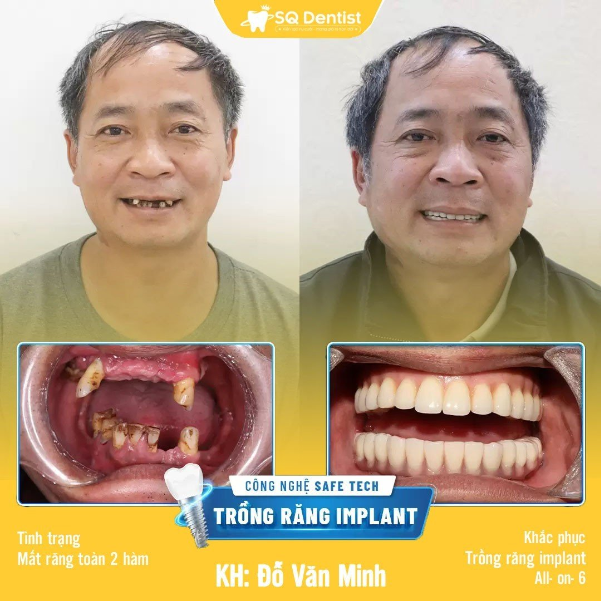 Tìm hiểu các dịch vụ nha khoa thẩm mỹ tại SQ Dentist - Ảnh 2.