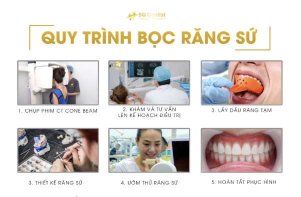 Tìm hiểu các dịch vụ nha khoa thẩm mỹ tại SQ Dentist - Ảnh 3.