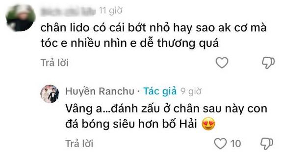 Con trai hơn 1 tháng tuổi bị &quot;soi&quot; vết bớt ở chân, Chu Thanh Huyền đáp lời khéo léo tiện thể &quot;flex&quot; về Quang Hải - Ảnh 2.