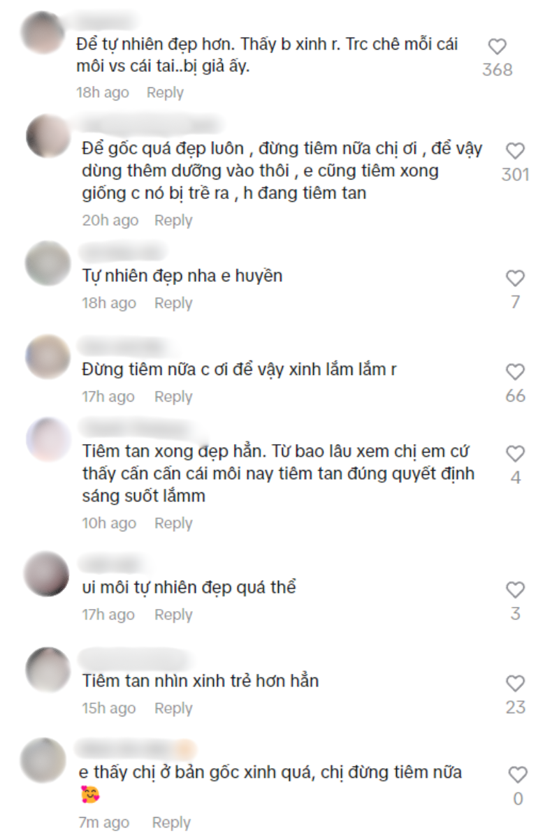 Một nàng WAG Việt từ bỏ môi mọng vì hệ quả tiêm filler, visual mới được netizen hết lời- Ảnh 4.