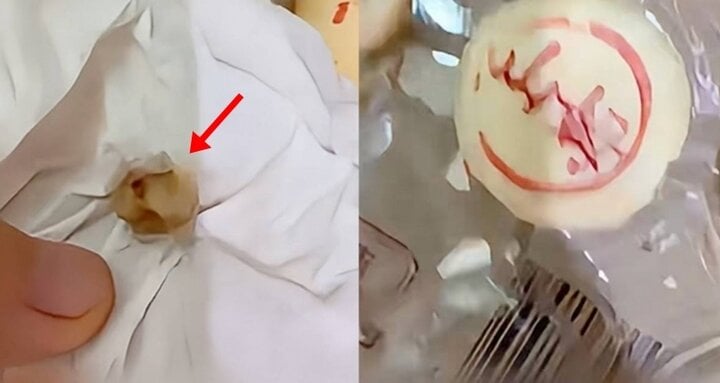 Cô gái sốc nặng khi phát hiện răng người trong bánh trung thu - Ảnh 1. Cô gái sốc nặng khi phát hiện răng người trong bánh trung thu - Ảnh 1.