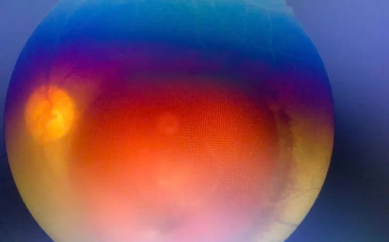 Tia laser trong đ&aacute;m cưới - hiểm họa kh&oacute; lường - Ảnh 1.