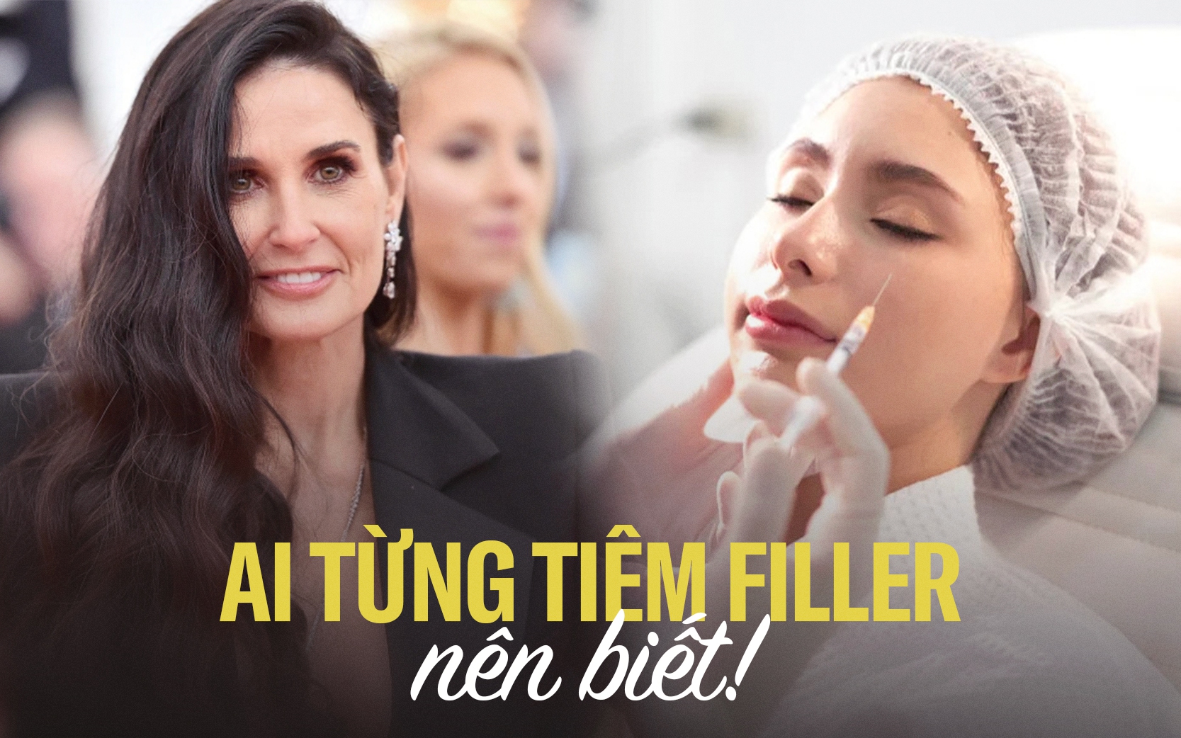 Tiêm filler nhiều khiến da bị chùng nhão, liệu bạn có thể cải lão hoàn đồng như các mỹ nhân Hollywood?