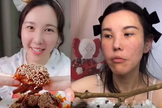 Mặt cô gái biến dạng sau 2 năm làm mukbang - Ảnh 4.