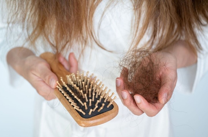 Những mẹo nhỏ giúp giảm rụng tóc vào mùa thu - Ảnh 1.