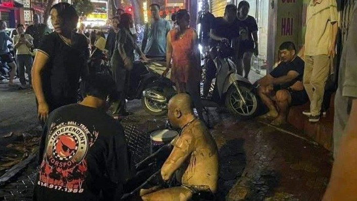 Điều tra nghi án tạt xăng, châm lửa khiến 3 người bỏng nặng - Ảnh 1. Điều tra nghi án tạt xăng, châm lửa khiến 3 người bỏng nặng - Ảnh 1.