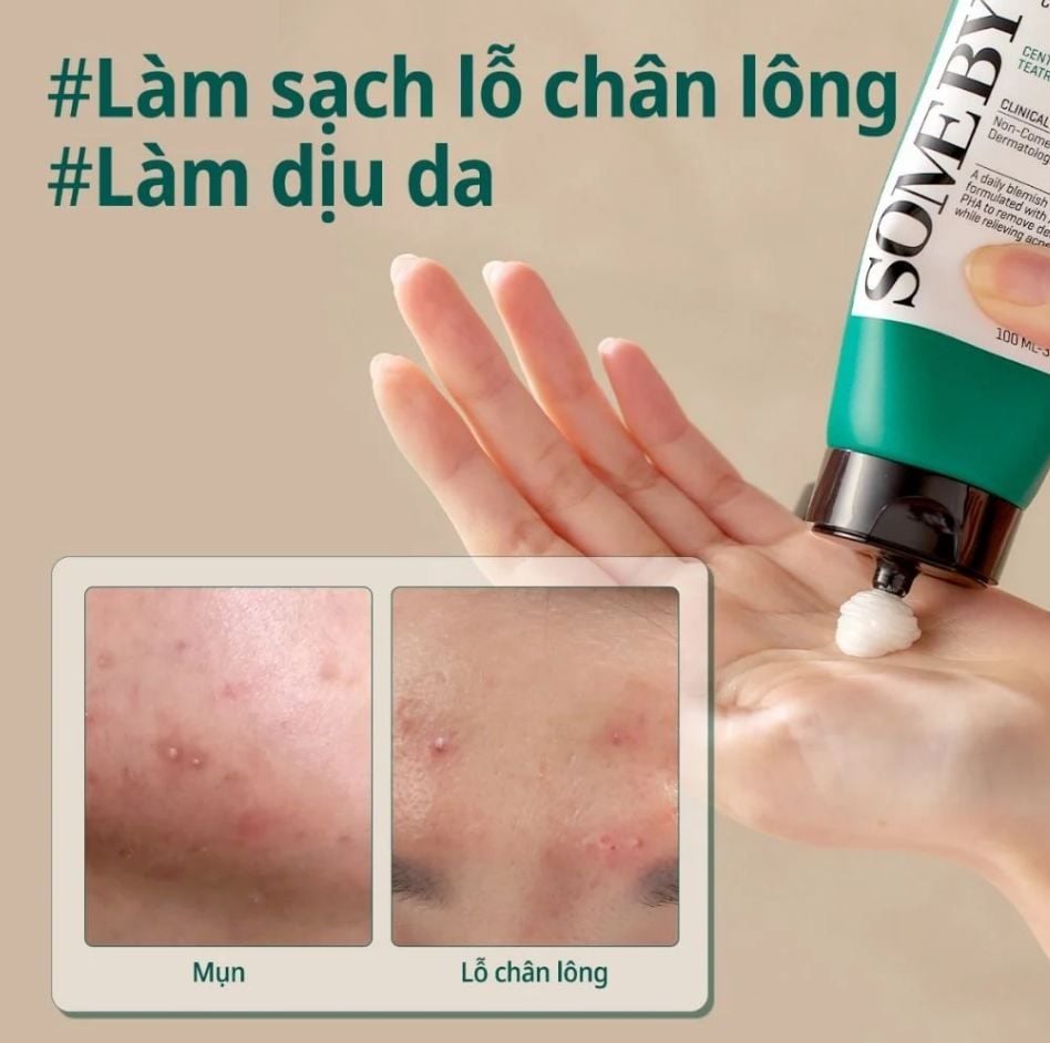 6 sữa rửa mặt đánh bay mụn đầu đen, làm sạch sâu lỗ chân lông mà không gây khô da - Ảnh 6. 6 sữa rửa mặt đánh bay mụn đầu đen, làm sạch sâu lỗ chân lông mà không gây khô da - Ảnh 6.